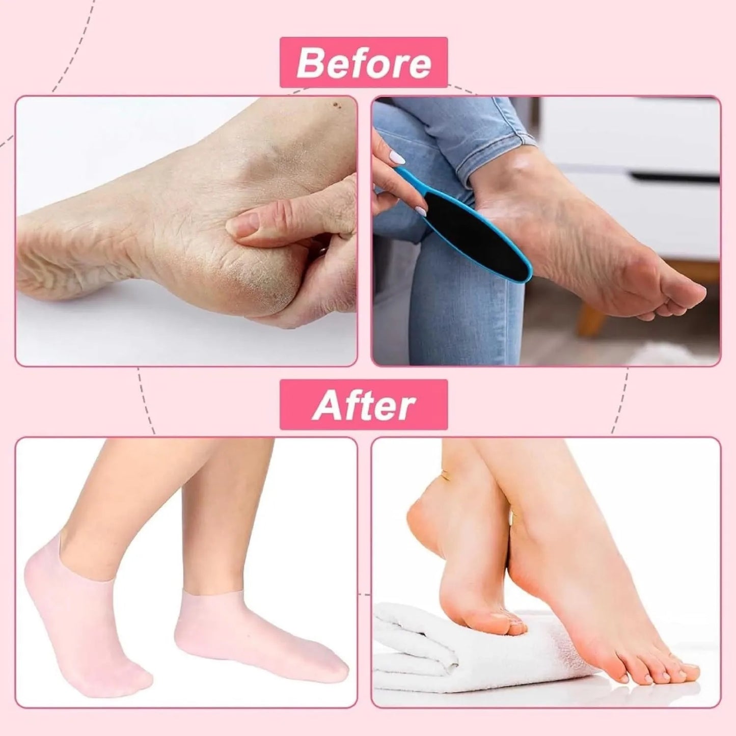 Buy 1 Pair Get 1 Pair Free Silicone Moisturizing Socks for Foot Care