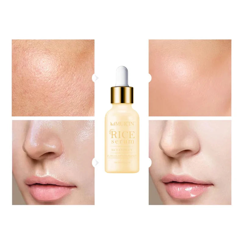 RICE SERUM FOR FAIRER & FLAWLESS SKIN - EVEN TONE PERFECTION