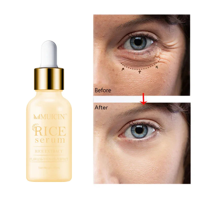 RICE SERUM FOR FAIRER & FLAWLESS SKIN - EVEN TONE PERFECTION